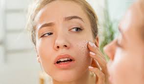 How to know if you have dry or dehydrated Skin??